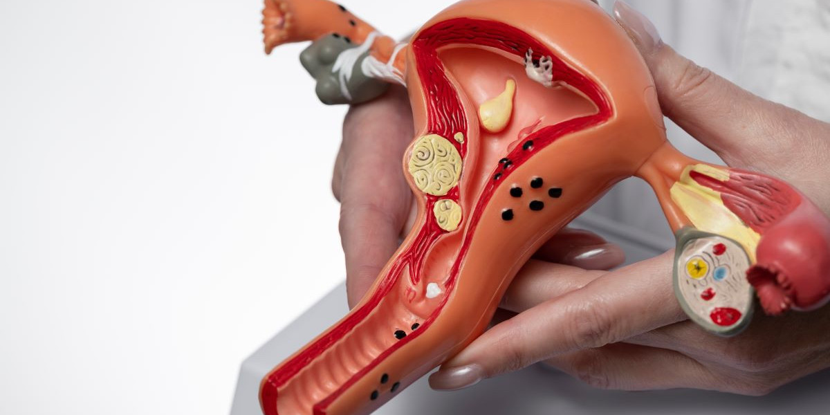 Polycystic Ovary Syndrome Drug Market Forecast and Insights